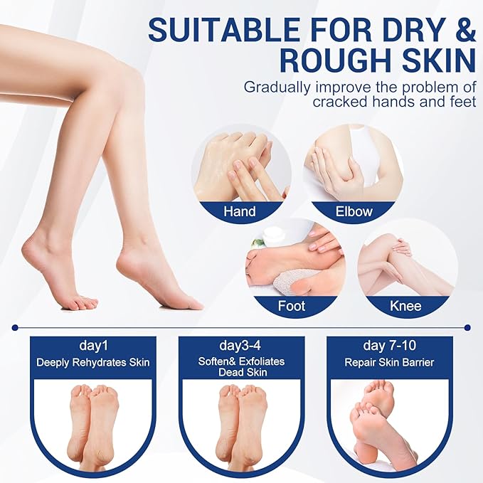 60% Urea Plus 2% Salicylic, Acid Foot Cream, Heel Balm Stick Aloe Vera, Urea Foot Cream, Nourish Foot Care, Heel Stick for Cracked Feet Hands, Knees, Hydrates & Exfoliates