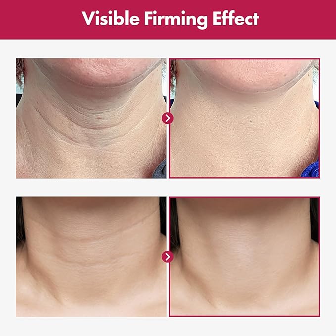 TOSOWOONG Collagen Necktox Cream with Collagen and Hyaluronic Acid for Neck Firming, Anti-aging, Wrinkles and Tightening, Korean Skin Care, 50ml, 1.69 fl. oz.