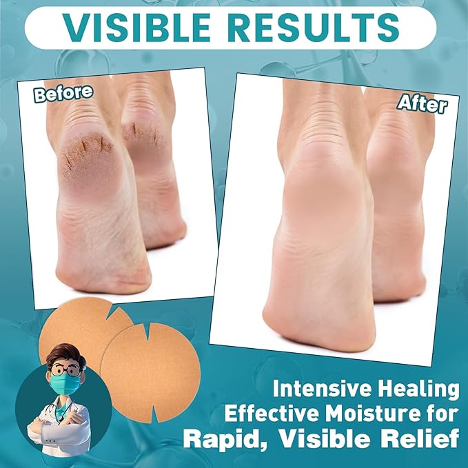 20PCS Patented Cracked Heel Treatment Patches, Cracked Heel Repair Bandage (100mm x 100mm)