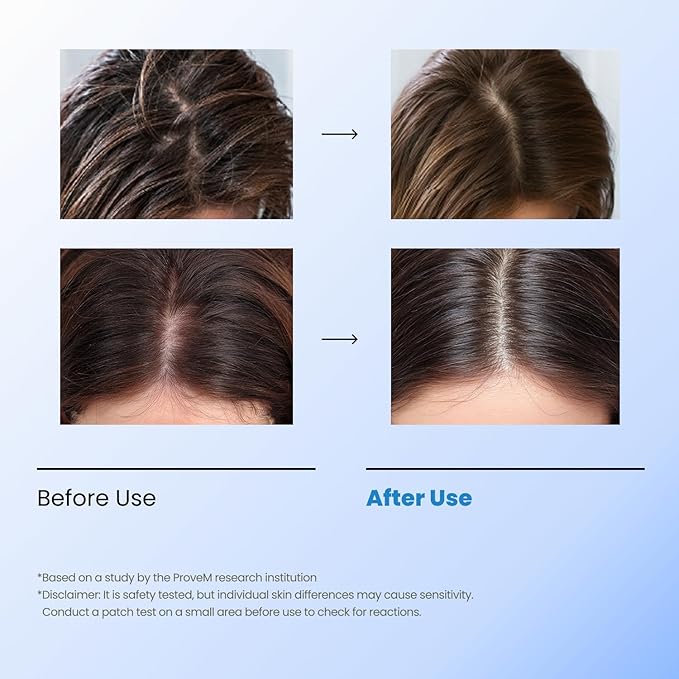 Bubble Tonic | Leave-In Scalp Exfoliator Foam for Oily, Sweaty, or Itchy Roots | Clears Buildup & Sweat with No Residue | Cooling Relief with Menthol & Salicylic Acid | Korean Hair Care Detox