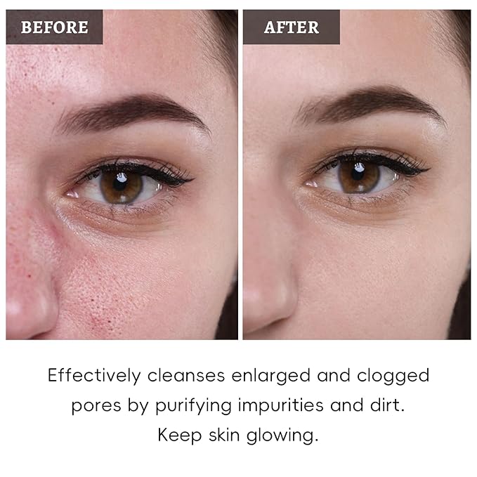 Face Mask Set, 4Pcs Clay Mask, Face Masks Skin Care with Vitamin C, Charcoal, Mugwort and Purple Clay, Skincare Christmas Gift for Blackheads & Oil Control, Stocking Stuffers for Teen Girls