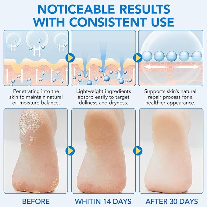 Urea Cream, Intensive Foot Repair Stick 60% Urea with 2% Salicylic Acid Heel Balm Stick, Maximum Strength Callus Remover Foot Care Cream for Cracked Heels, Dry Feet & Rough Skin