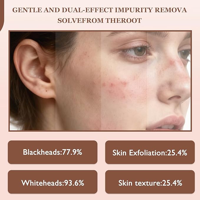 Rice Peel Shot Glow Rice Ampoule Duo | Pore Minimizing Gentle Peel & Deep Hydration |Black Rice Exfoliant for All Skin | 6.76 Fl Oz 2Pcs