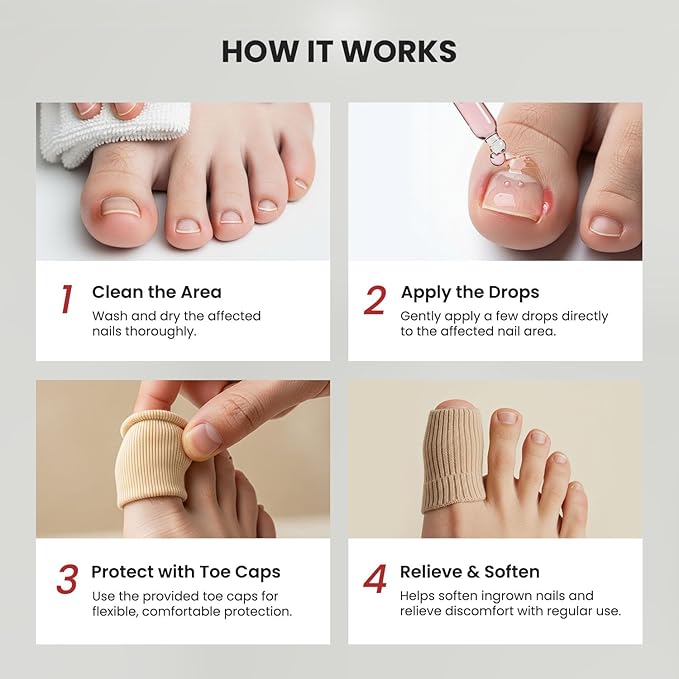 Treatonic Ingrown Toenail Treatment - Ingrown Toenail Pain Reliever and Softener Kit for Easy Trimming with Silicone Gel Toe Caps