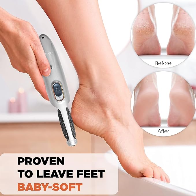 Powerful Electric Foot Callus Remover for Men - Rechargeable Pedicure Foot Grinder Files Away Dead, Hard Skin and Calluses on Heels for Smooth Soft Feet (Silver Grey)