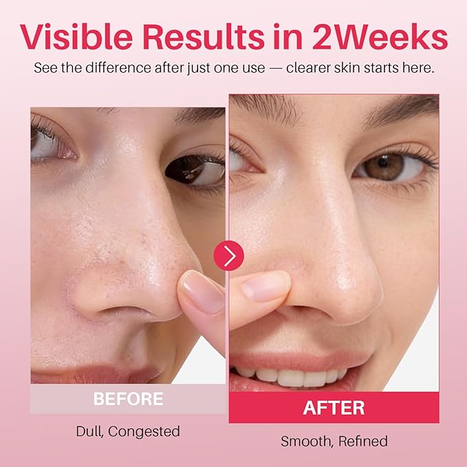 PDRN Collagen Gel Toner Pads with Salmon DNA, Pore Tightening, Skin Plumping Sheets for Elasticity, Hydration & Sensitive Skin, Natural-Inspired Soothing Mask for Teens, 70 Count