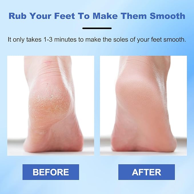 Veinsgrain Foot File, Nano Glass Foot File, Hard Skin Remover Nano-Glass Foot File, Veins Grain Foot File, Professional Foot Care Tools, Pedicure Tool for Smooth Feet (Blue)