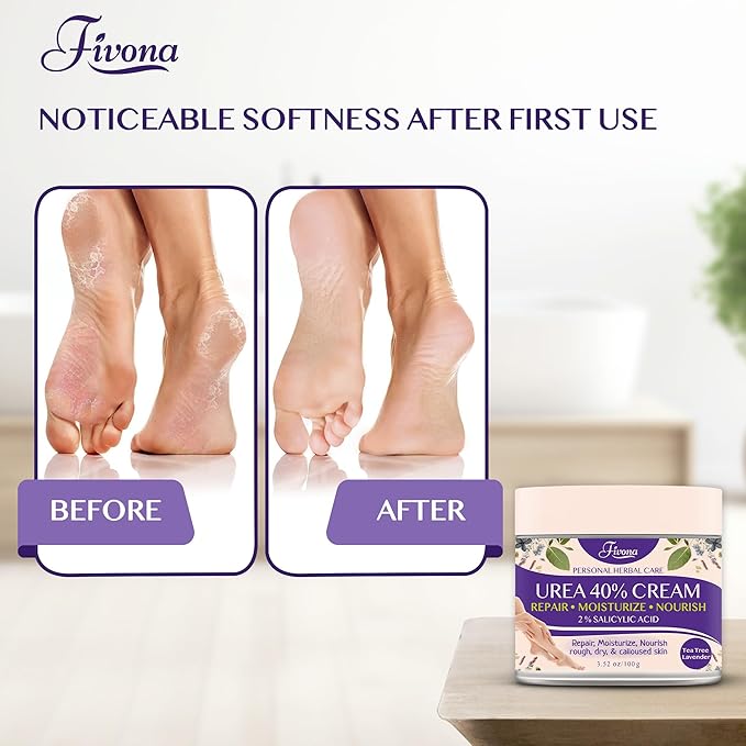 FIVONA 40% Urea Cream with 2% Salicylic Acid - Foot Cream with Tea Tree and Lavender Extracts Foot Lotion for Dry Cracked Heels, Dead Skin & Callus Remover, Feet Moisturizer Repair Cream