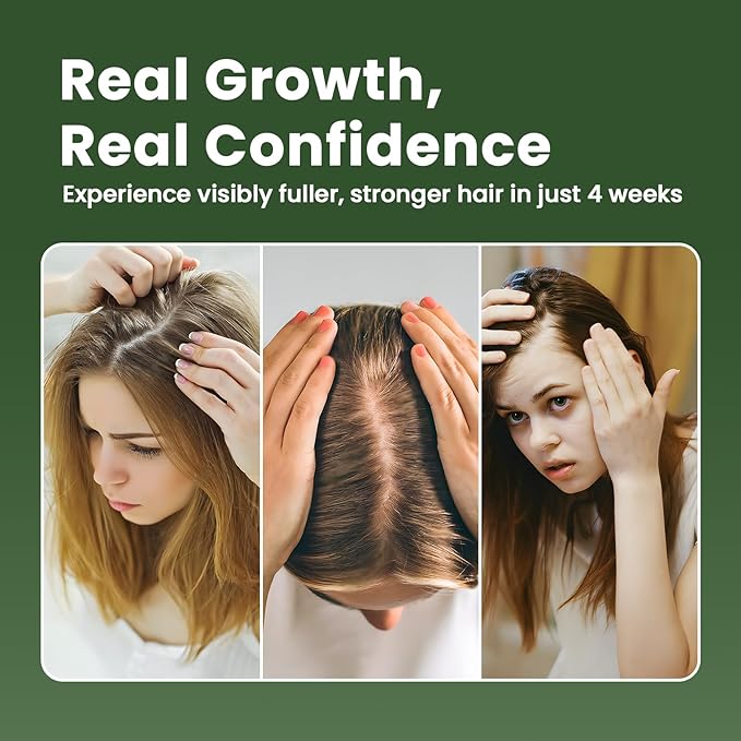 Hair Growth Oil with Rosemary Castor Oil Vegan Strengthening Formula for Thinning Hair Regrowth Treatment in Natural Vegan Hair Serum to Nourish Scalp Stimulate Follicles 3PCS for Man and Women