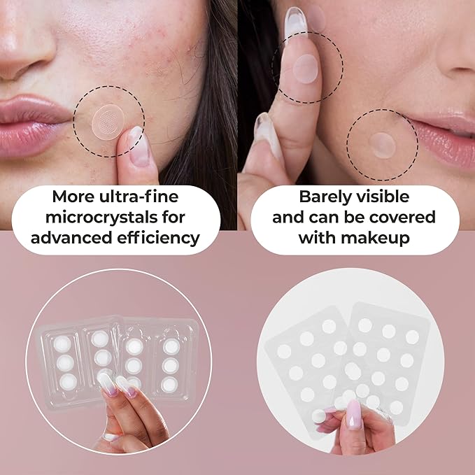 OMMA 144 Patches Pimple Patches for Face and 36 Microdart Acne Patch Bundle