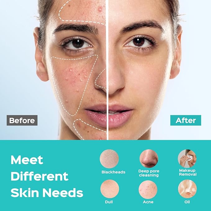 COSLUS Facial Cleansing Brush Face Scrubber: Silicone Waterproof Rechargeable Face Wash Brush, 5 Cleansing Modes, Electric Deep Cleaning for Men & Women, Removing Blackhead, Exfoliating, Massaging