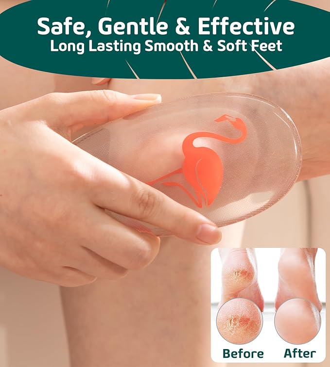 Glass Foot File Callus Remover for Feet, Flamingo Gifts for Women, Feet Scrubber Dead Skin Remover, Professional Pedicure Tools at Home, Heel Scraper for Cracked Heels Heavy Duty