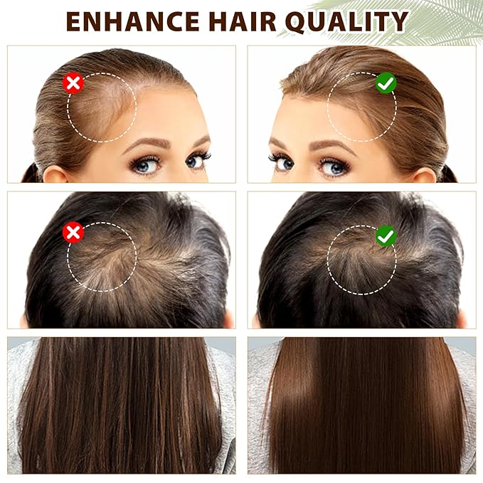 100% Natural Pure Batana Oil for Hair Growth, Unrefined Organic Raw Batana Oil Hair Growth Oil for Prevent Hair Loss, Enhances Hair Thickness, Repairs Damaged Hair for Men & Women (4.2 fl oz)