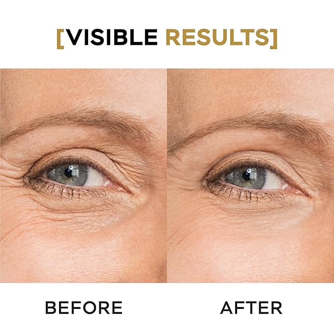 VITASEI Moisturizing Eye Cream w/Aloe Vera, Collagen, Hyaluronic Acid, Cotton Stem Cells for Dark Circles, Puffiness & Bags - Under Eye Hydration Cream for Women & Men (1 Fl Oz)