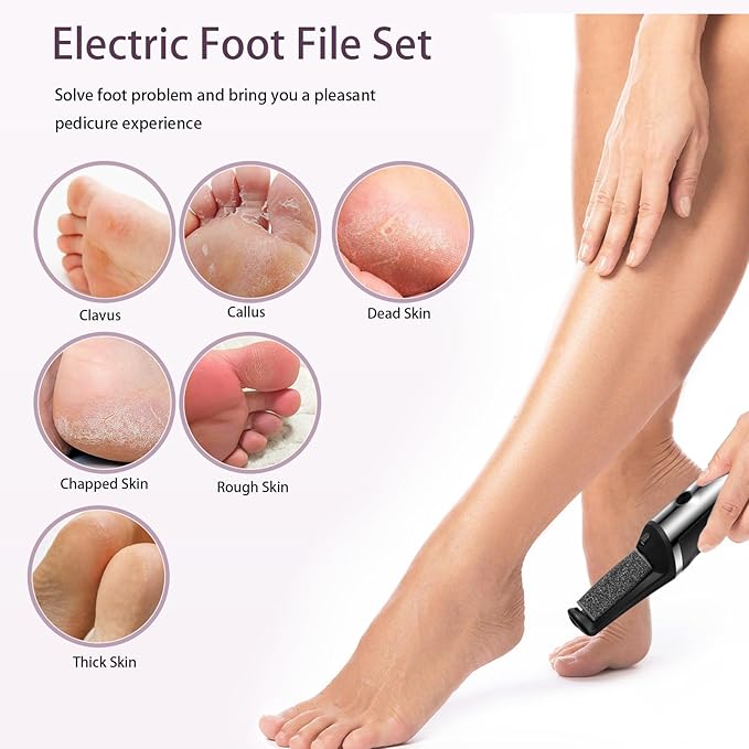 Electric Foot Callus Remover,Smooth Pedicure Wand Rechargeable Electric Foot File,Professional Pedicure Tools for Dry, Dead, Cracked, Hard Skin, at Home Feet Spa Care Kit for Men & Women