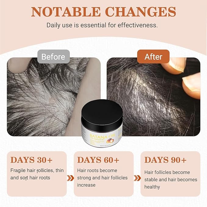 100% Natural Raw Batana Oil for Hair Growth,Organic Raw Prevents Hair Loss, Leaves Hair Smoother, with Keratin, Coffee Extract & Other Ingredients to Enhance Efficacy for Thicker ﻿ (Pack of 2)