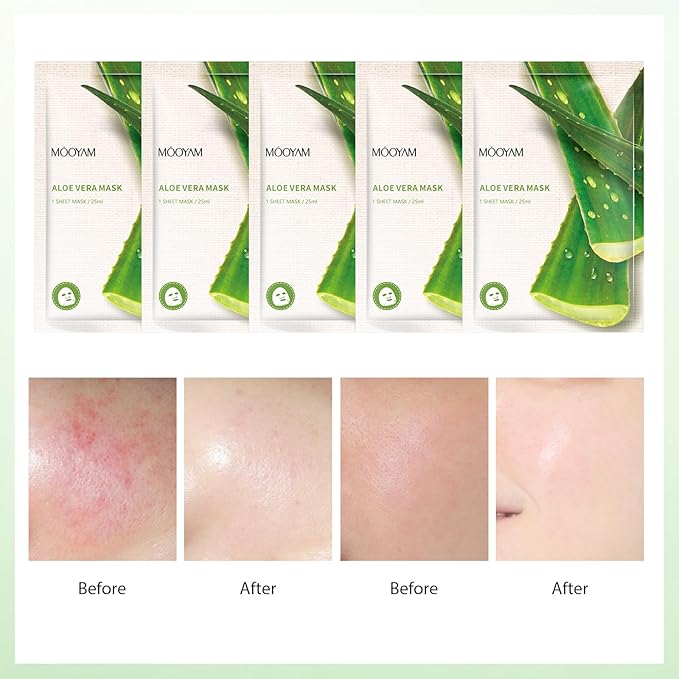 Facial Masks Skincare for Women,Aloe Vera Moisturize Face Mask Sheet for Girl,Hydrating Face Mask for All Skin Types,Dry Skin & Sensitive Skin (10-Packs)