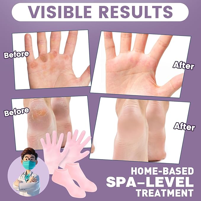 2 Pairs Silicone Socks Gloves Set for Dry Cracked Feet Hands, Silicone Moisturizing Socks for Women, Hand Foot Care, Spa Gel Socks Gloves After Pedicure (Socks Fits Up to Size 10)