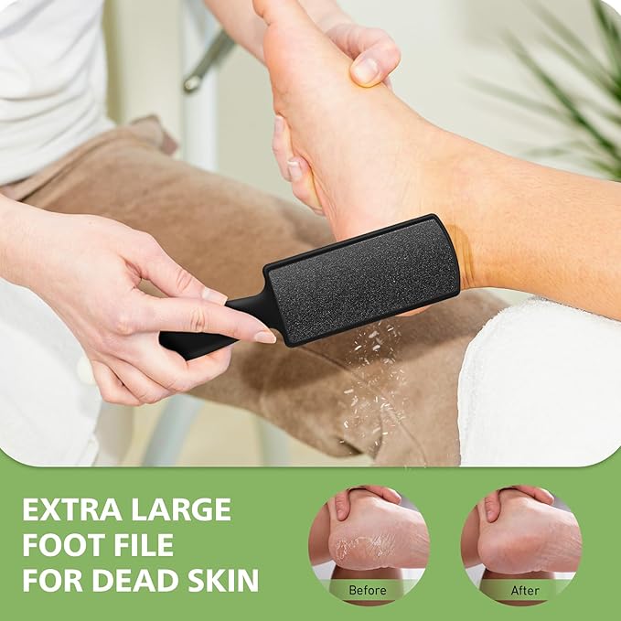BALUCA Foot Files Callus Remover Stainless Steel Foot Rasp and Dual Sided Feet File Professional Scrubber Pedicure Tools Premium for Feet Care Remove Hard Skin, Black