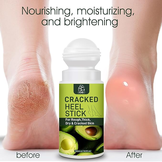 Daily Foot Moisturizer Cream, Feet Cream for Dry Cracked Heels Knees Elbows Hands, with Salicylic Acid & Macadamia Ternifolia Seed Oil & Shea Butter, Deeply Moisturize and Remove Calluses, 1.763 Fl.Oz