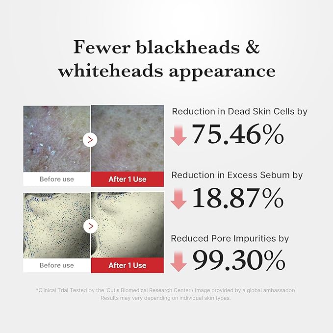 medicube Hypochlorous Acid Rice Peel Shot | Gentle Exfoliating Serum for Dead Skin Cells & Pore Care, Blackheads & Excess Sebum Control | Rice Extract, Panthenol for Hydrating & Smoothing Care