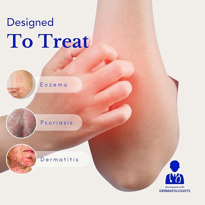 Theraplex Eczema Treatment Bundle - AIM Itching Cream (3 Oz) & Eczema Therapy (6 Oz) for Itch Relief - Strongest Anti Itch Cream & Moisturizer - for Itchy Skin Treatment