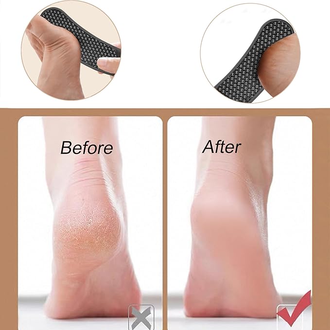 Nano Glass Foot File,Foot Callus Remover Hard Skin Remover for Feet with Handle Foot File Callus Remover with Nano-Level Grinding Points Durable Foot Scrubber Dead Skin Removal for Wet Dry (Black)