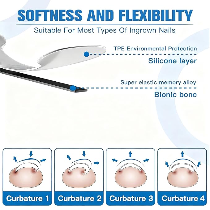 10-Piece Pack Titanium Alloy Ingrown Toenail Corrector,Curved Toenail Repair Patch,Memory Metal Ingrown Toenail Physical Correction Tool,Ingrown Toenail Removal Tool Set,Nail Aesthetic Shaping Tools.