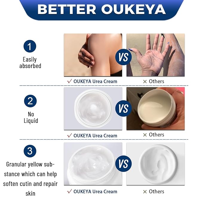 OUKEYA Urea Cream 40 Percent, Foot & Hand Cream for Dry Cracked, Urea Lotion for Feet Maximum Strength(12.35Oz X 4 Packs)