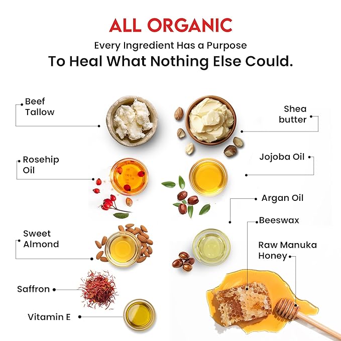 Whipped Tallow Honey Balm – Grass-Fed Beef Tallow infused with Manuka Honey, Rosehip, Jojoba & Almond Oils – No Essential Oils, Nourishing Face, Neck & Body Lotion, 100% Organic (Unscented - 2 oz)