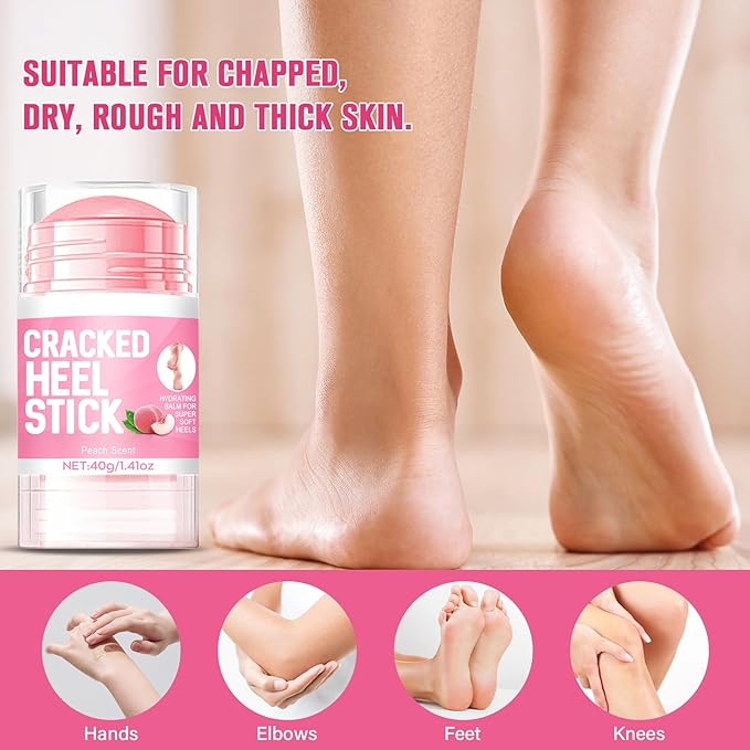 2PCS 60% Urea Hydrating and Anti-Cracking Foot Cream，2025 Upgraded Hand and Foot Cream Urea Moisturizer，Hydrates Dry and Cracked Feet and Hand (1.41 Ounce, Peach)