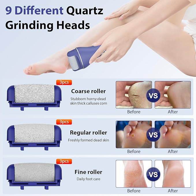 Electric Callus Remover for Feet, Rechargeable Portable Electronic Foot Callus Remover 2-in-1 Wet/Dry Foot Scrubber Electric Toot File for Hard Cracked Dry Dead Skin（Blue）