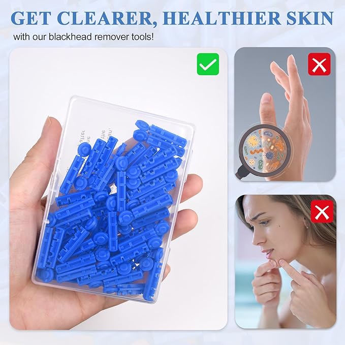 Acne Needle, 50 Pcs Disposable sterile Needles and 70 Dots Pimple Stickers for Acnes, Whitehead, Comedone Removal (122 Piece Set)