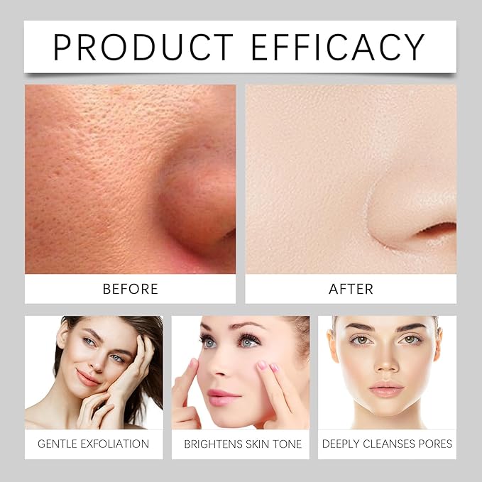 Black and White Rice Peeling Ampoule, Deep Pore Cleansing Soft Exfoliating Face and Body Scrub Dead Skin All Skin Types. (White Rice)