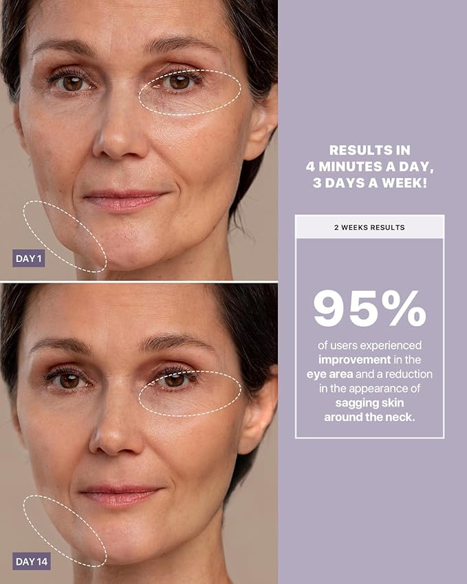 AMIRO R3 Turbo Facial Beauty Tool – Full-Face & Eye Area Skincare Enhancer for a Lifted-Looking, Smoother Appearance – Purple