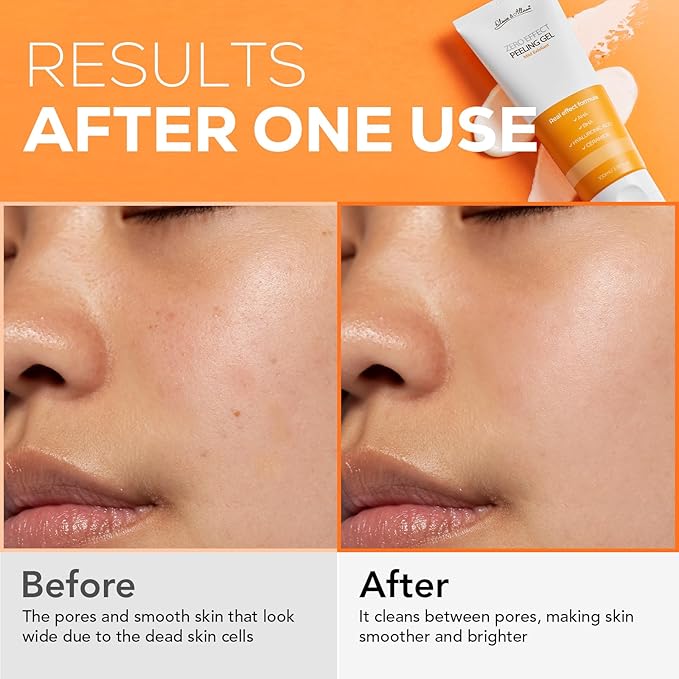 Olivia & Allison ZERO EFFECT PEELING GEL 3.38fl oz (100ml) Natural BHA + AHA + Ceramide Exfoliating Gel