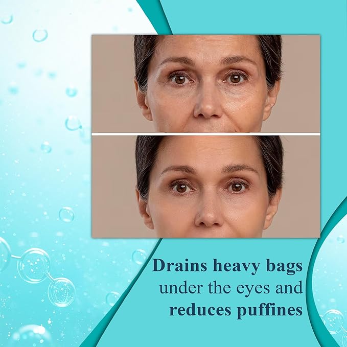 Elite Serum Rx - Anti Aging Under Eye Serum for Dark Circles and Puffiness with 7 Patented Peptides - Extra Strength Eye Lifting and Firming for Wrinkle Repair and Bags Treatment