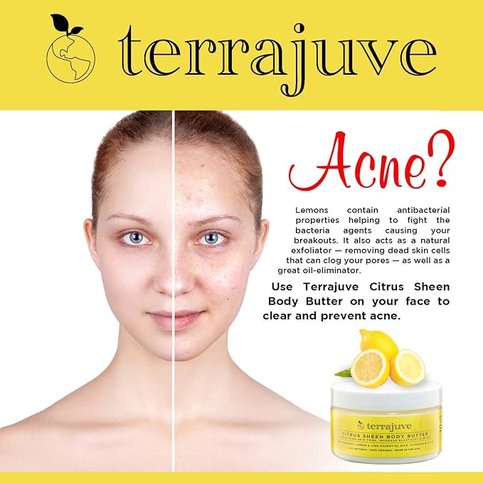 Lemon Body Butter Essential Cream Lotion for Women, Helps Even Skin Tone, Increase Elasticity, and Glow, with Organic Lemon and Lime, Shea Butter, Vitamins B, C and E, All Natural, Made in USA