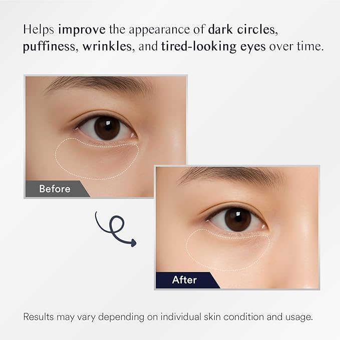 Under Eye Patches for Dark Circles: 30 Pairs Eye Gel Mask for Puffy Eyes and Bags with Retinol Collagen - Undereye Brightening Hydrating Anti-Wrinkles Women