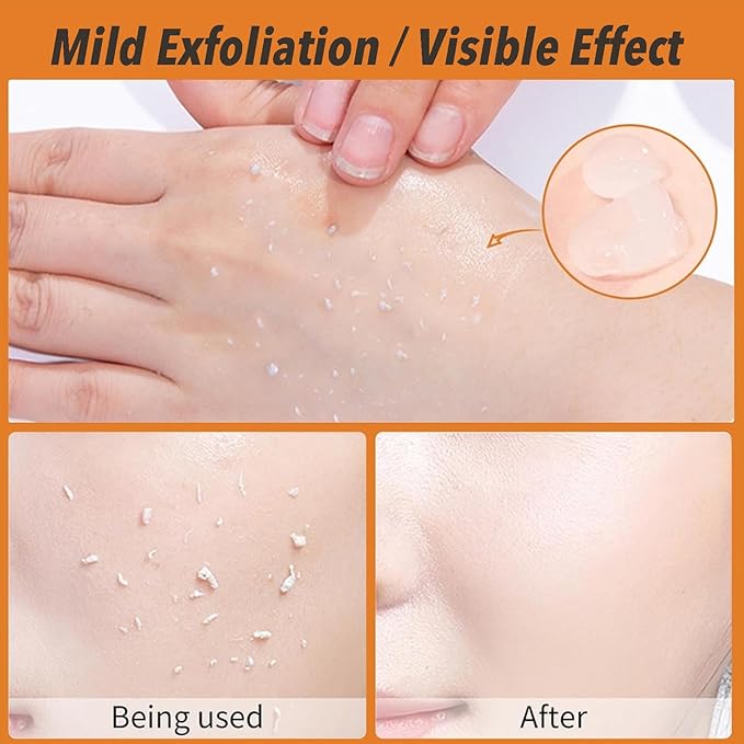 Orange Exfoliating Gel, Face & Body Scrub, Natural Orange Peeling Gel Moisturizing Face Scrub, Gentle for All Skin Types(2PCS)