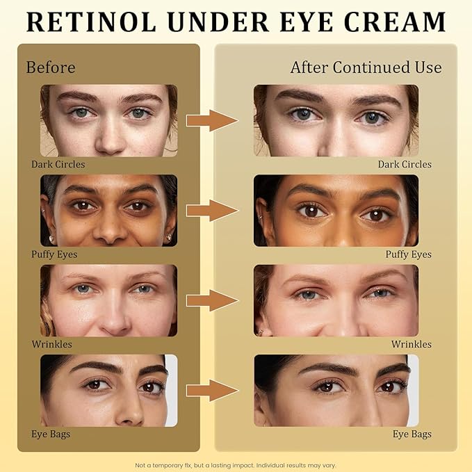 Retinol Eye Cream for Dark Circles, Wrinkles & Puffiness - Under Eye Cream with Anti-Aging Formula to Smooth Fine Lines, Eye Tightener & Reduce Eye Bags,Eye Firming Cream 1 Fl Oz