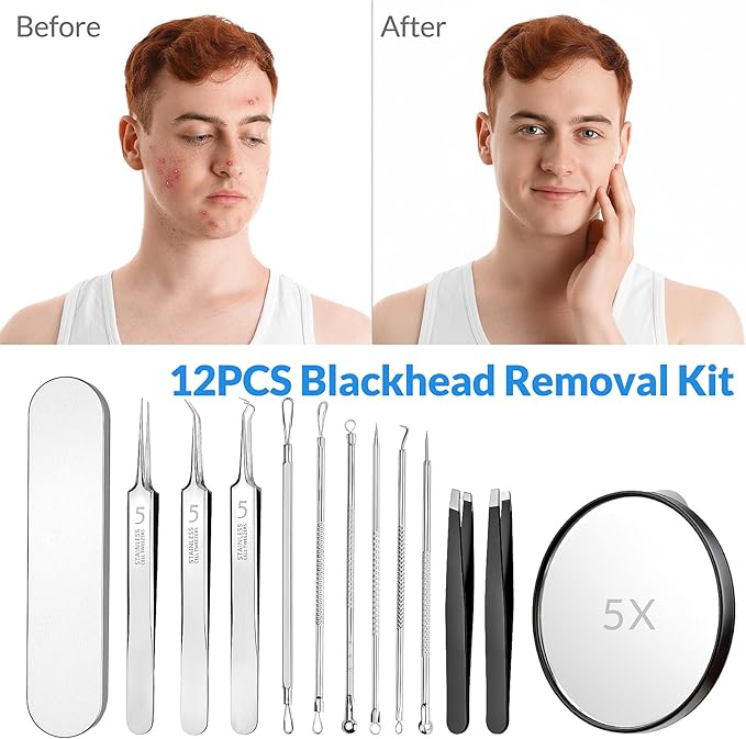 Pimple Popper Tool Kit 12PCS: 9 × Blackhead Removers, 2 ×Eyebrow Tweezers, 1 × 5X Mirror, Stainless Pimple Extractor, Blackhead, Acne, Blemish, Facial Hair Removal Tools Kit (Black)
