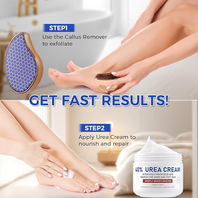 OUKEYA Urea Cream 40 Percent for Foot & Hand Cream with Foot Files for Dry Cracked,Urea Lotion for Feet Maximum Strength