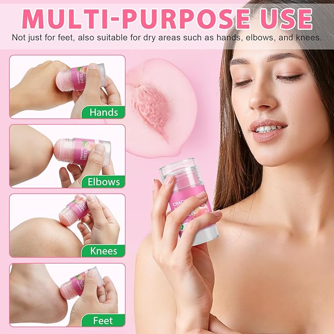 Urea Cream Foot Callus Remover Stick - 60% Urea with 2% Salicylic Acid, Professional Strength Moisturizer for Dry Cracked Feet, Heels, Knees, Elbows & Hands, Callus Removal & Skin Softening Treatment