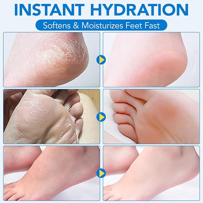 Urea Cream, Intensive Foot Repair Stick 60% Urea with 2% Salicylic Acid Heel Balm Stick, Maximum Strength Callus Remover Foot Care Cream for Cracked Heels, Dry Feet & Rough Skin