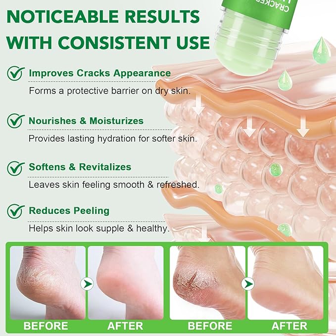 Urea Cream 60% Plus Salicylic Acid 2% Foot Balm Stick for Dry Cracked/Chapped Heel, Skinned knees, Hand Intensively Hydration/Moisturization, Callus Removal/Softening/Soothing-Aloe Scent|1.41 Oz/40 G