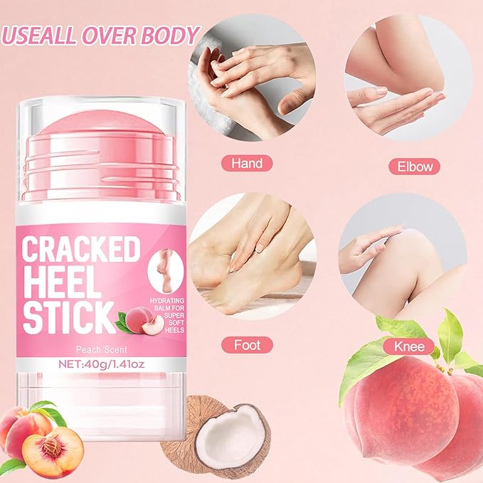 60% Hydrating Urea Foot Cream,Cracked Heel Stick Plus 2% Moisturising Salicylic Acid, Foot Balm Stick for Removing and Smoothing Cracked Hands Elbows Feet Knees, Peach Scent Heel Balm Repairs Dry Skin
