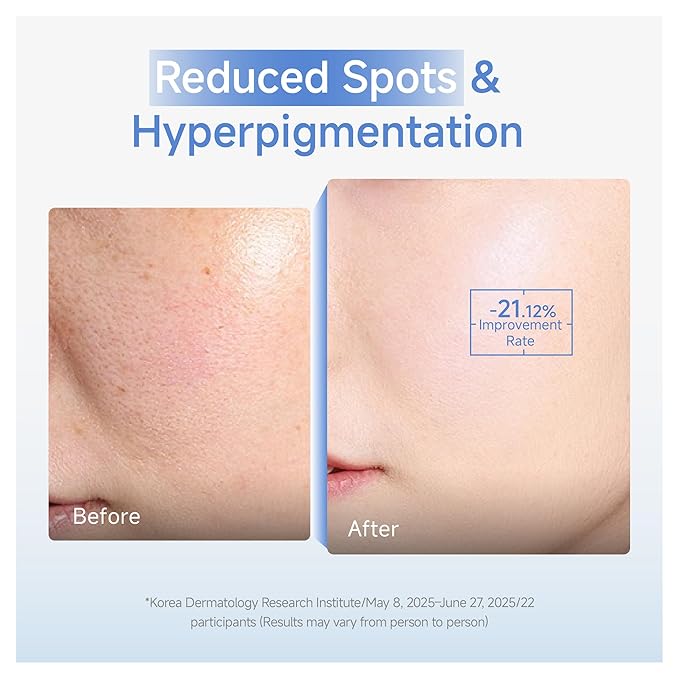 DAERA Synergy Boost Ampoule - Brightening Face Serum & Dark Spot Correcting Ampoule with Calcium Up+ Complex, Anti-Aging Serum Fades Wrinkles, Korean Skincare for Glowing Skin, 30ml