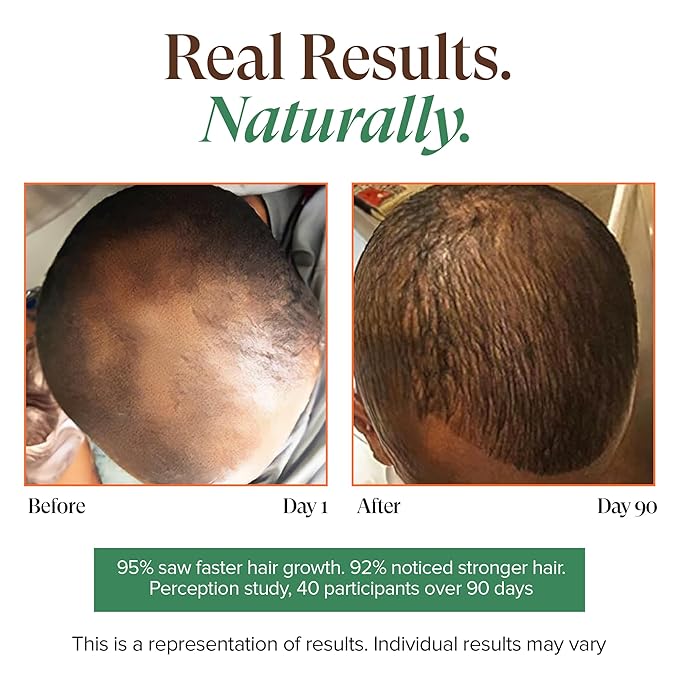 Kreyol Essence - Haitian Black Castor Oil for Skin and Hair, Glass Bottle - Fuller-Looking Hair, Pure, Hexane Free, Cold Pressed, Natural Humectant