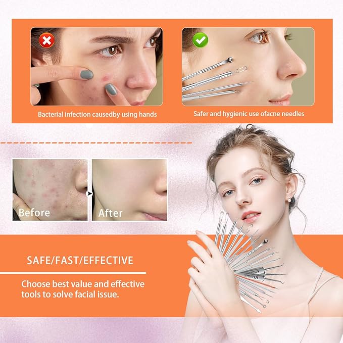 2025 Professional Pimple Popper Tool Kit, 20 PCS Blackhead Remover Tools，Blackhead Remover Comedone Extractor Tools for Removing Zit on Face - Acne Removal Kit with Metal Case (Silver)